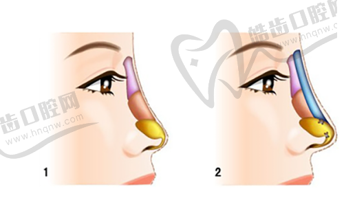 七、選擇正規(guī)機構(gòu)的重要性：避免不規(guī)范操作導致的“被迫持續(xù)使用”