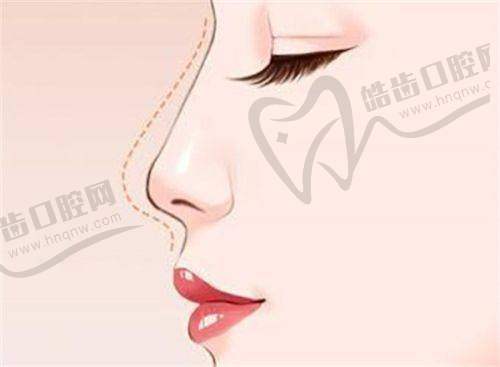 六、朝阳区仁安联合丽格医院袁强博士掌握的拉皮技术有哪些