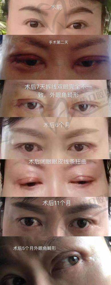 昆明彼心医疗美容门诊部项目特色
