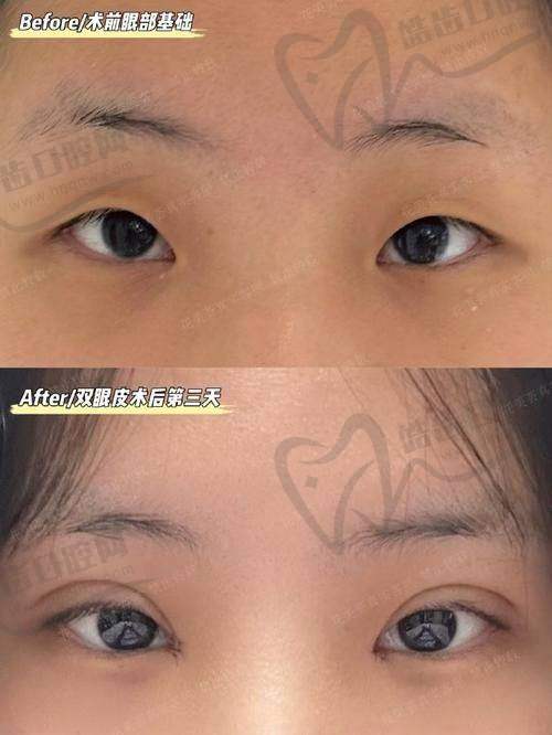 一、韩兴斌整形医生个人资料曝光：20年+经验，鼻综合提升50%稳定性，双眼皮修复闭眼无痕！