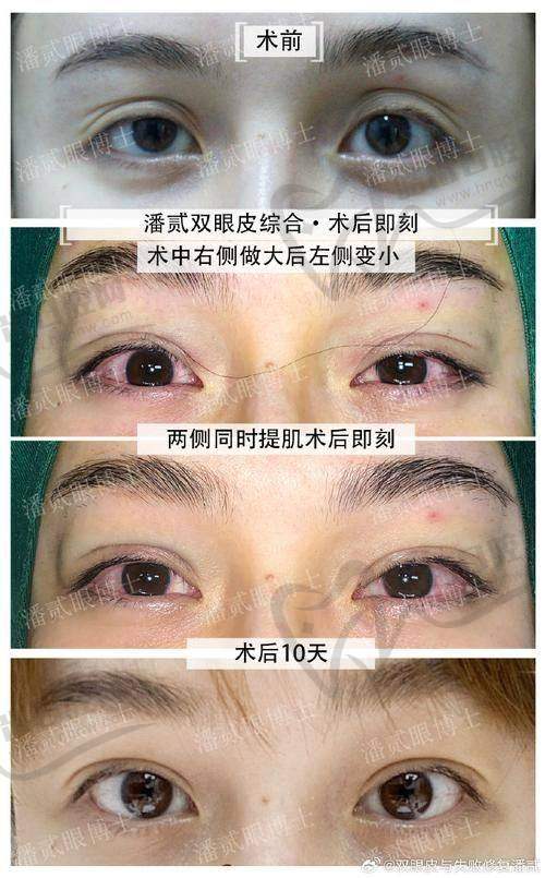 昆明赫柏整形医疗美容门诊部怎么样，口碑评价如何？