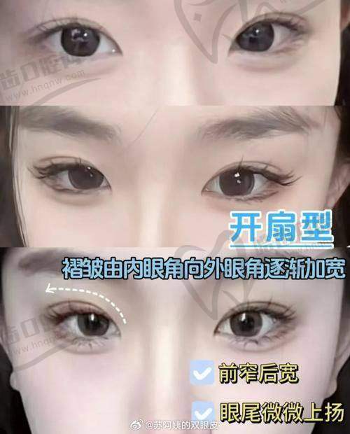 周静医生的顾客好评见证变得更美奇迹