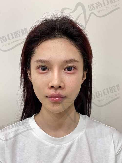 谢占军 医生的技术优势