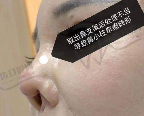 昆明赫柏整形医疗美容门诊部价格表