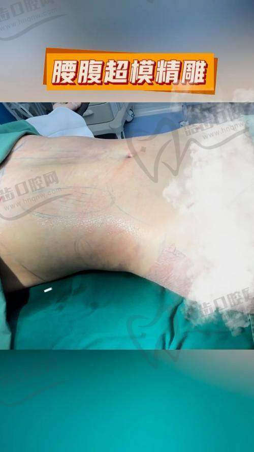 谢占军 医生擅长的项目