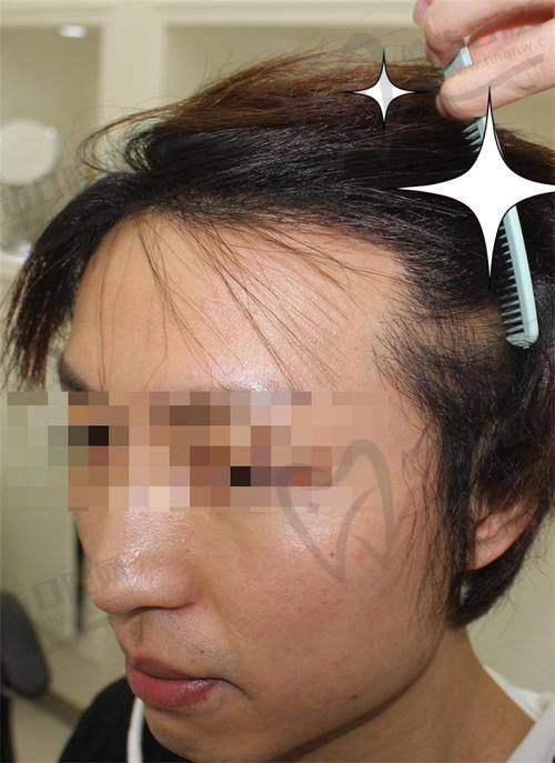 杜茂华医生治疗皮肤问题的技术优势