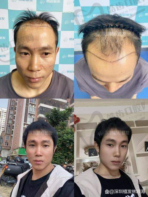 杜茂华医生的个人资料深度解读