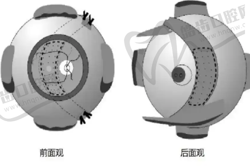 六、轻美颜诊所：眼周专科的硬核配置