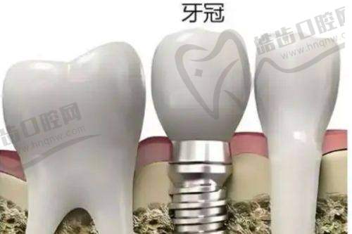 ✨环境服务体验？谁说看牙不能像茶馆一样放松