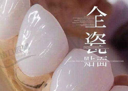 上半口种植牙收费如何？难度与价格关系