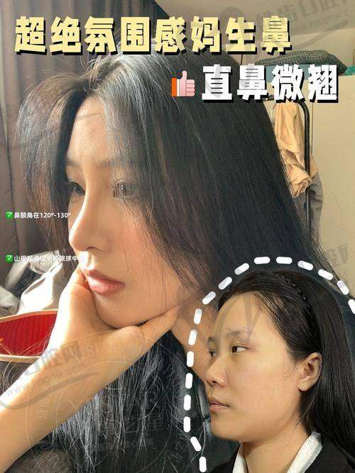 “妈生鼻”五大审美原则：东方人专属理性标准