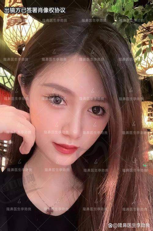 戴传昌医生鼻整形风格：自然和谐派，强调原生骨相美