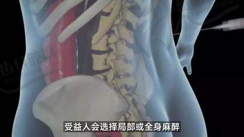 鲁天宇隆胸技术怎么样？从资历与团队优势看起