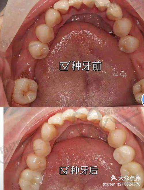 ?院内消毒流程+卫生标准，不输三等甲