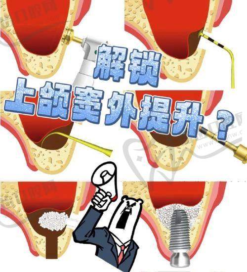 1. 必须警惕的重度症状