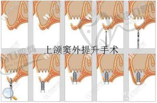 3. 必须避免的清洁误区