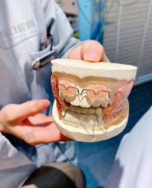 牙齿矫正在线问诊流程详解