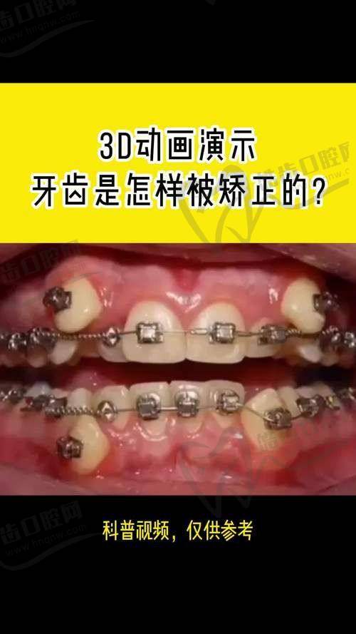 矫正牙齿在线询问医生免费服务内容