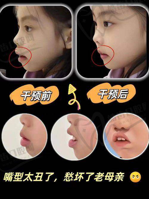 为什么成人天包地无法自行改善？