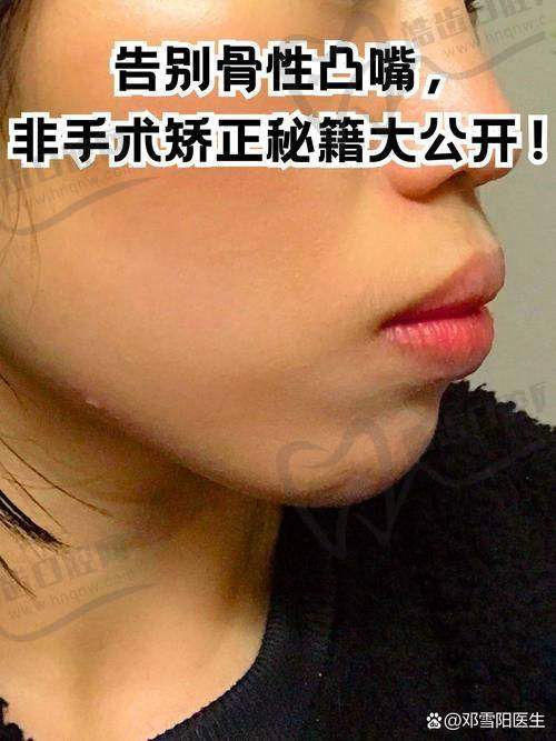 2. 不良习惯纠正：从源头减少畸形诱因