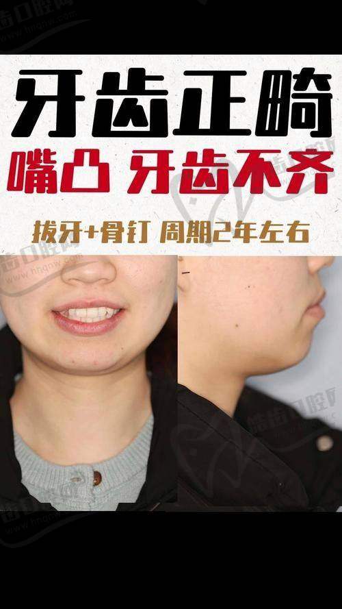 天包地不矫正的危害：别让“小问题”拖成“大麻烦”