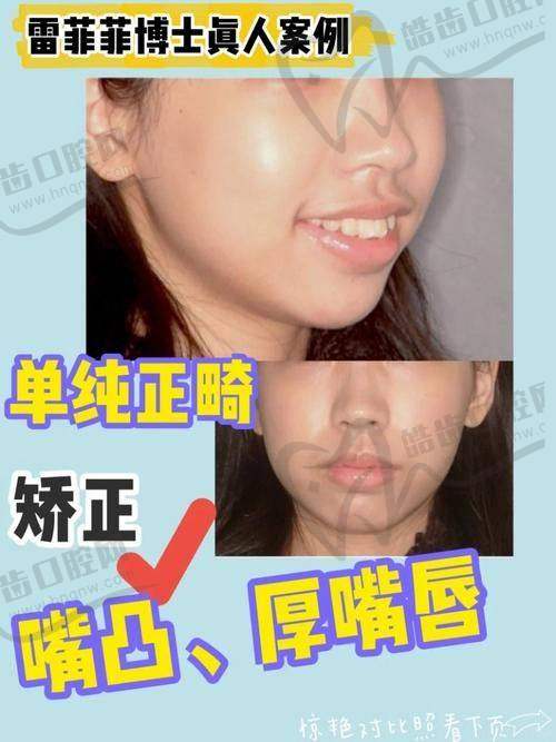 总结：天包地自己可以慢慢改吗？关键在“早发现+科学干预”