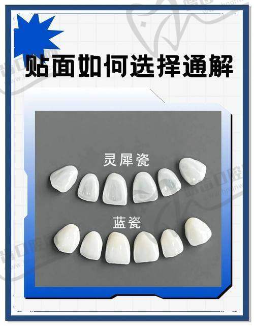 清远粤美口腔超薄瓷贴面2349元/颗，微创修复牙问题保留更多健康牙体 