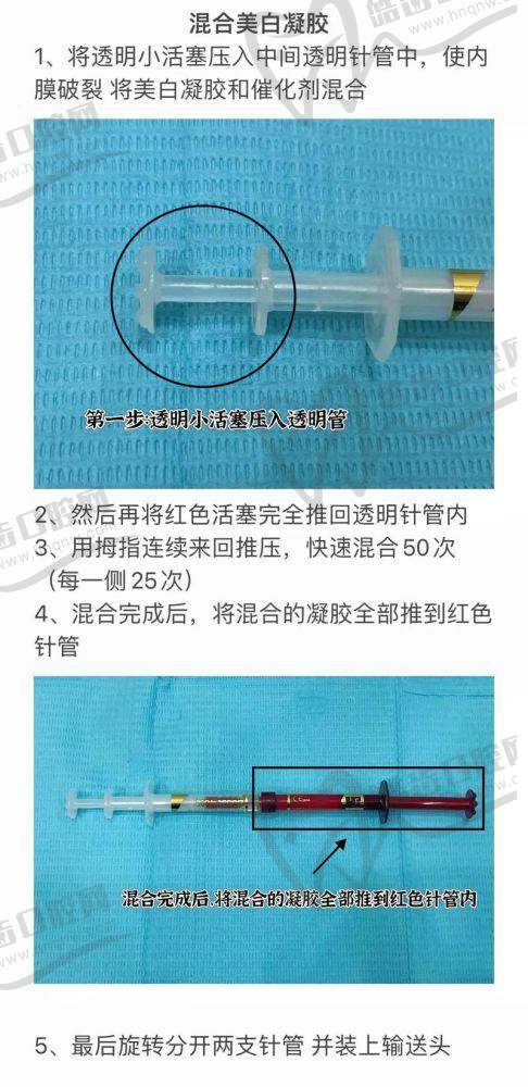 什么是牙齿皓齿美白？