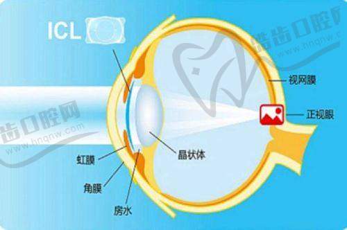 保山今视佳眼科诊所收费价格表/收费标准