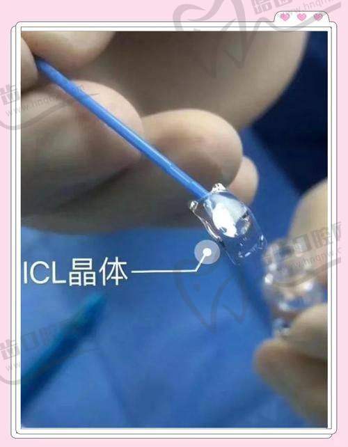 保山昌宁华鼎眼科详细的预约挂号方式及流程