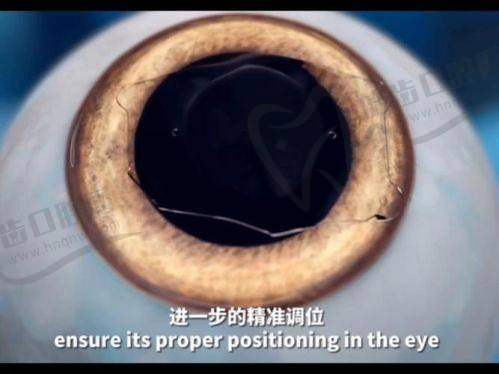 保山腾冲兆西眼科简介概述