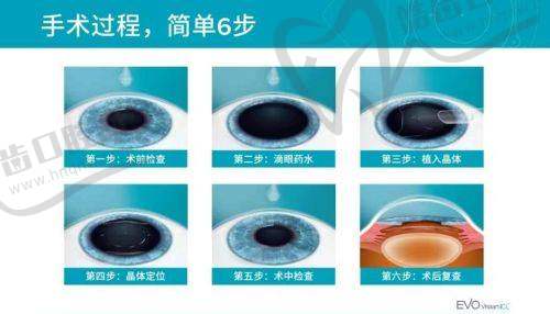 保山腾冲视明眼科医院地址电话营业时间