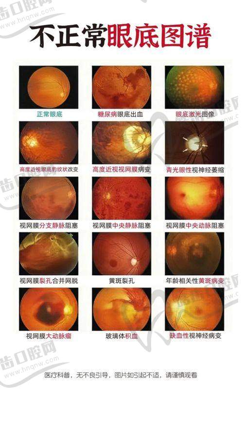 拉萨美朵谐松眼科医院特色项目及技术优势