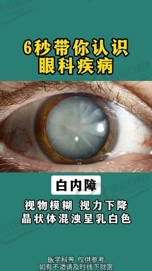 拉萨美朵谐松眼科医院真人口碑评价怎么样？