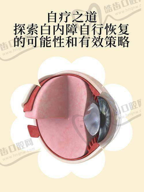 保山艾维眼科医院特色项目及技术优势