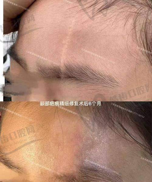除了面部整形，黄威医生团队其他项目收费标准也不算离谱