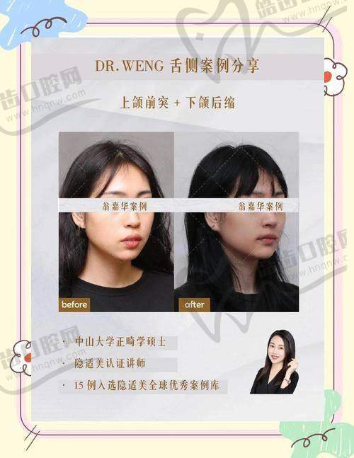 动作二：“唇肌对抗”练习（每日3次，每次3分钟）