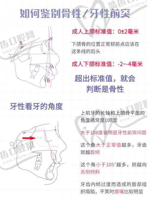 天包地更简单三个纠正动作：医生推荐的家庭训练方案