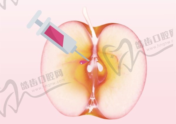 昆明韩辰薛芝兰私密紧缩11000元起，双学科名家定制方案，改善松弛效果超棒