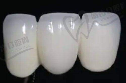 西宁诺贝尔口腔根管治疗400元起，分层收费医生定制方案，受患者好评与信任！