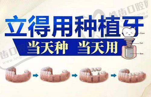 深圳金麦芽口腔医院种植牙技术优势