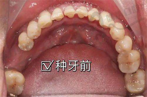 五、玉柴门诊