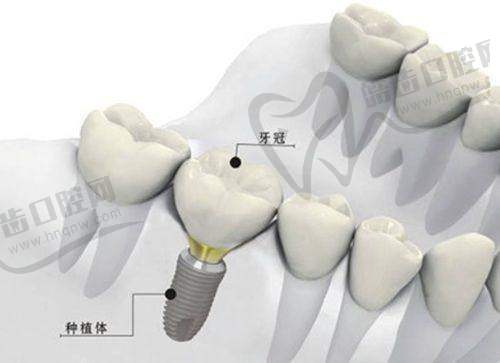 金华牙博乐口腔门诊部特色项目及技术优势