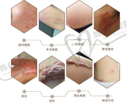 结语：西安艺星徐智慧医生靠谱吗？答案是肯定的！