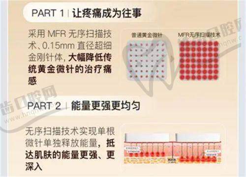 黄金微针治疗后的注意事项