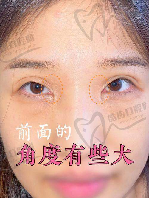 谭敏峰眼部修复口碑评价：真实好评让人放心！