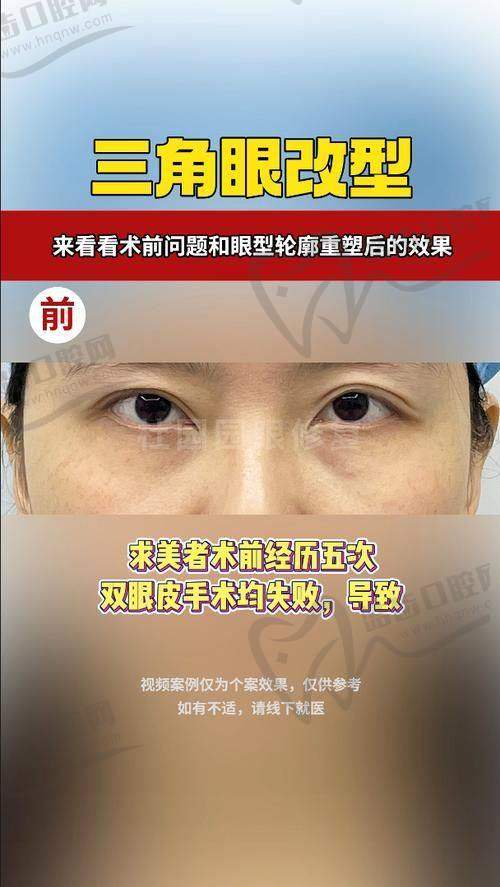 谭敏峰目前坐诊机构有哪些？广州深圳两地可约，正规医师认证