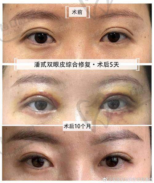 沈阳百嘉丽整形医院地址+热门项目速报：到院必看这3个“王牌”