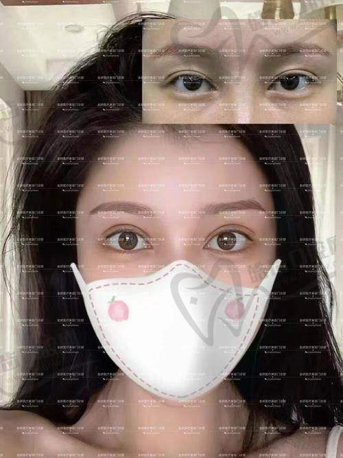【沈阳百嘉丽医院双眼皮怎么样】王滨福1万起|叶薇薇3000元起！医生技术强（2025价格表）