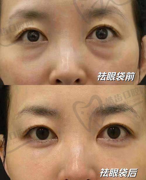 沈阳百嘉丽整形医院是正规医院吗？地址&预约攻略在此！  